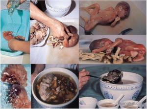 Sup bayi manusia, kelakuan manusia berhati iblis yang sanggup melakukannya (Gambar sengaja di kecilkan, untuk gambar lebih besar klik gambar)